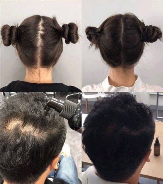 Tinh dầu kích mọc tóc TERAPIC Hàn Quốc Premium Total Hair Tonic- Sản phẩm tóc tốt nhất Hàn Quốc