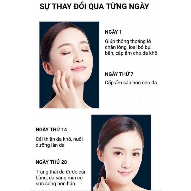 Hộp mặt nạ sủi bọt thải độc da Jlisa (bioaqua)