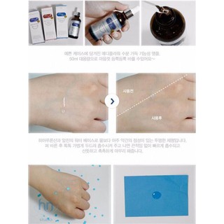 SERUM MỜ THÂM NÁM TRẮNG DA MEDI FLOWER