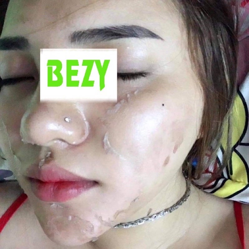 Tái Tạo Lột Thay Da Trắng Hết Nám Bezy