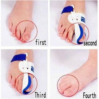 Dụng Cụ Định Hình Ngón Chân Cái [Giá đẳng cấp]