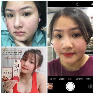 THANH LĂN MINI - NỬA LỌ NGỌC SÂM