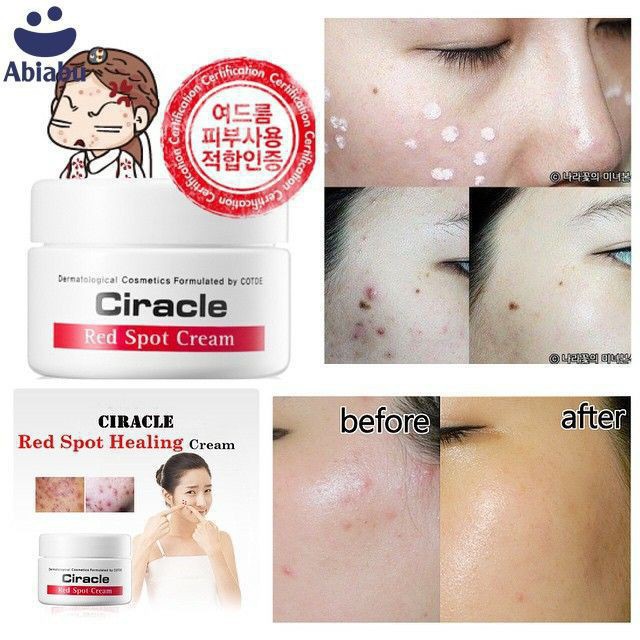 Ciracle Red Spot Cream [Sạch mụn 100%-Hàng Auth]  Kem Ciracle giảm mụn, xóa mờ vết thâm, trắng da hiệu quả