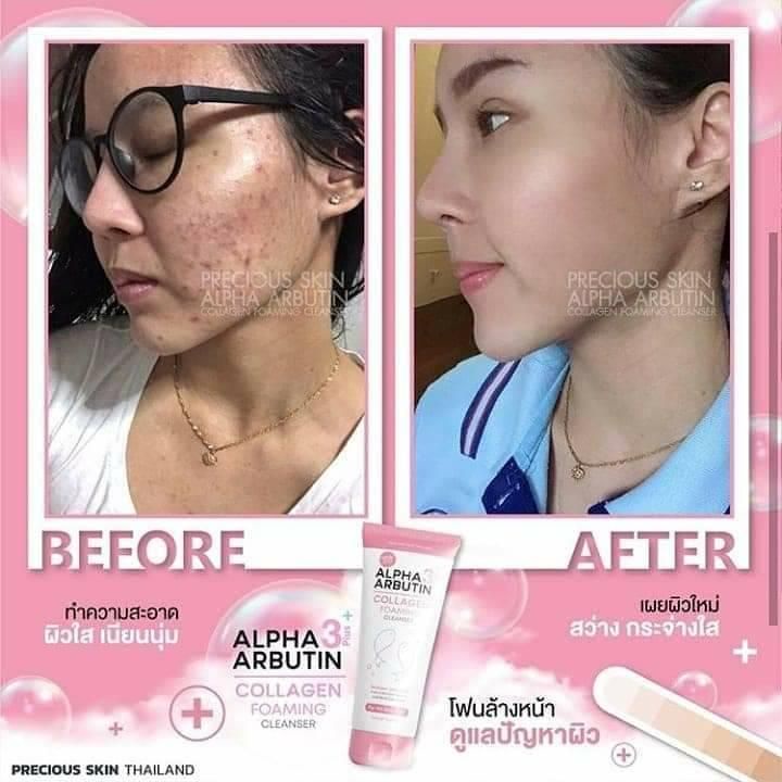 Sữa Rửa Mặt Dưỡng Trắng Da Ngăn Ngừa Mụn Alpha Arbutin Collagen Foaming Cleanser Thái Lan 120ML Chính Hãng - LAI'S STORE