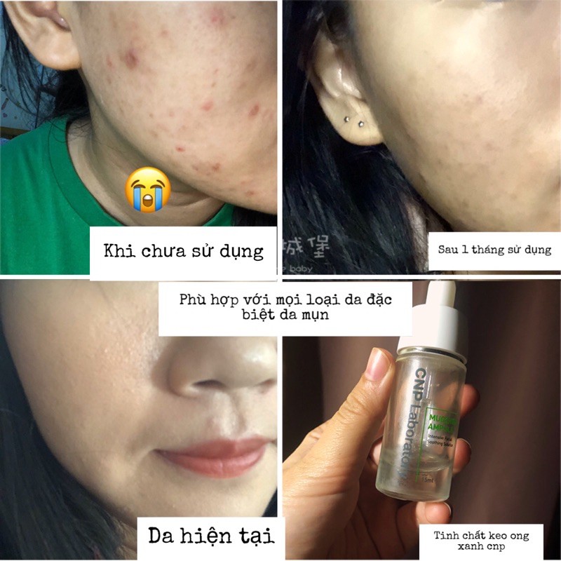 TINH CHẤT KEO ONG XANH CNP GREEN PROPOLIS ANTI OXIDANT AMPULE CHỐNG LÃO HOÁ 1ML | BigBuy360 - bigbuy360.vn