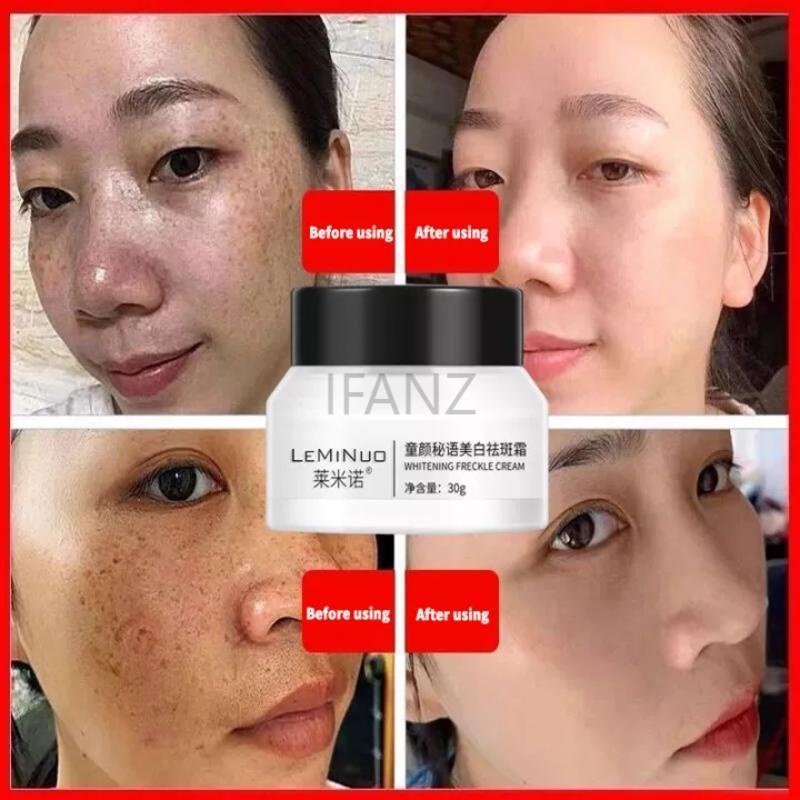 Kem Hỗ trợ giảm tàn nhang Làm Trắng Da Loại Bỏ Nám Sắc Tố Melanin Dưỡng Ẩm Chống Lão Hóa 30ml