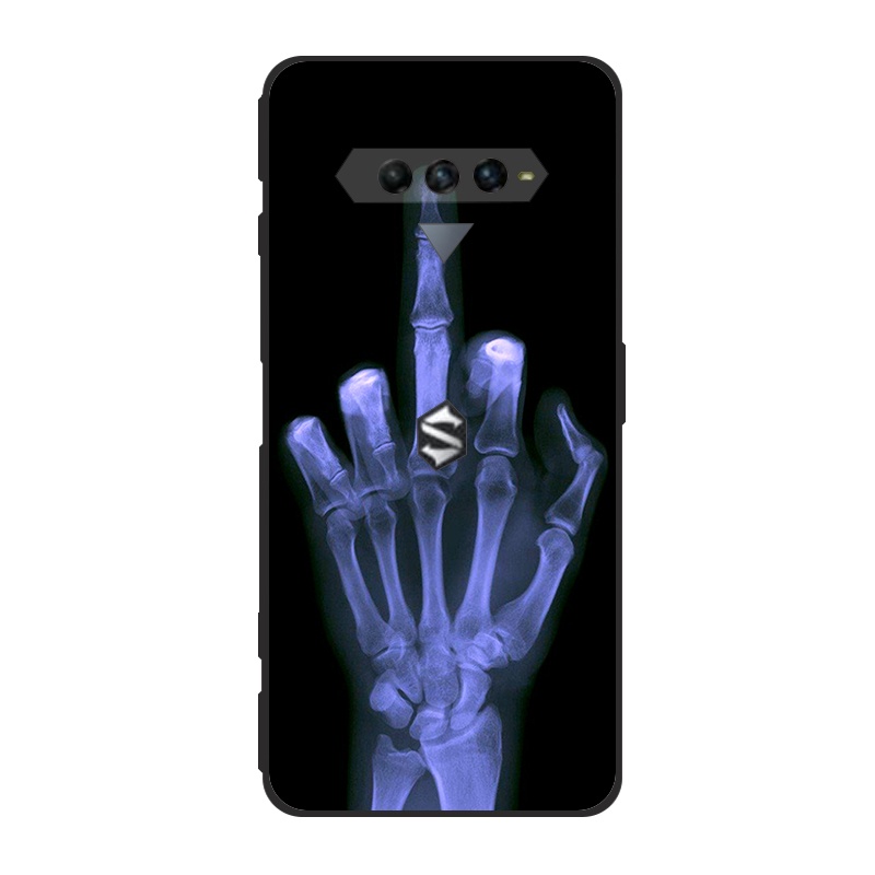 Ốp Điện Thoại TPU Silicon Mềm Cho Black Shark 4 Black Shark 4S