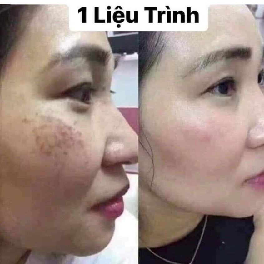 Viên Uống Trắng Da - Mờ Nám - Giảm Nếp Nhăn GLUTATHIONE 600 ĐR LACIR