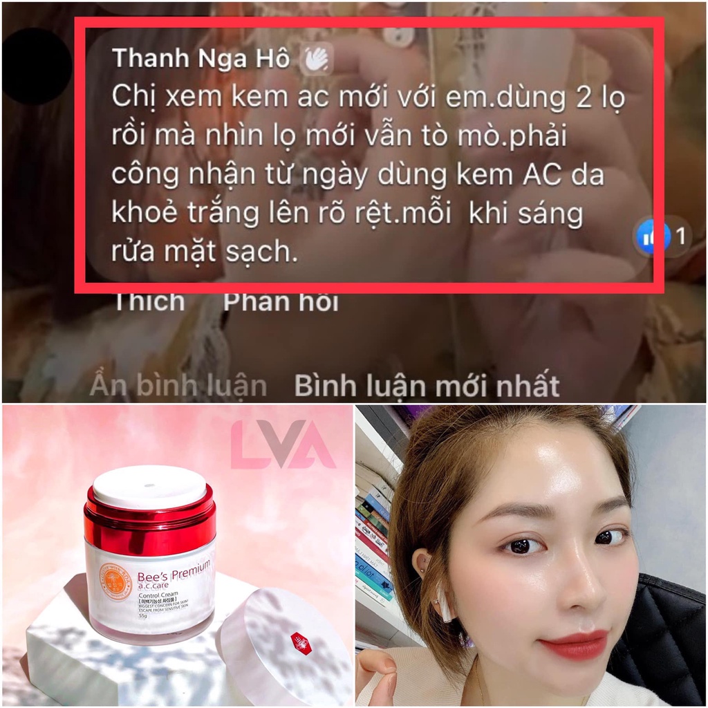 Kem dưỡng ngừa mụn, mờ thâm nám từ nọc ong AC Care Bee's Premium Control Cream 55g phiên bản 2022