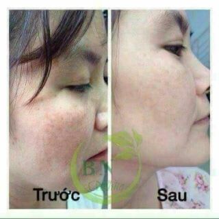 Serum bn white