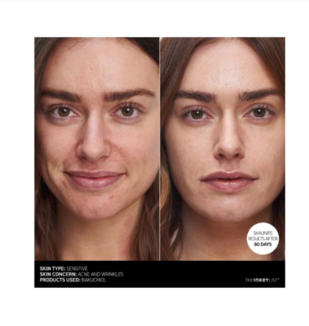 Kem dưỡng The INKEY List Bakuchiol 30ml  - một thay thế tự nhiên cho Retinol