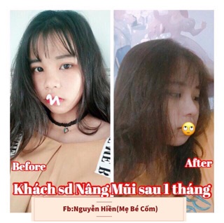 Serum Nâng Mũi Hàn