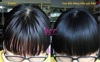 Dầu Gội Khô Batiste