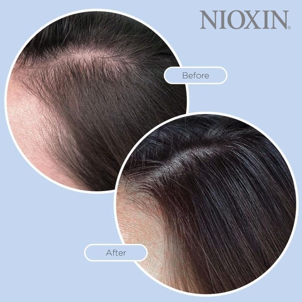 Tinh chất dưỡng tóc Nioxin chiết xuất thiên nhiên giúp bảo vệ tóc và da đầu, tăng độ dày của tóc lọ 100ml