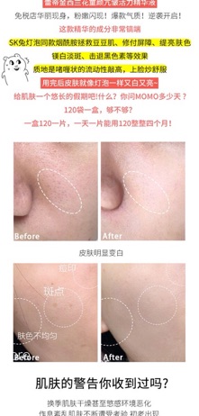 Tinh chất Ladyskin cho da mụn