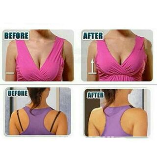 Kẹp cố định dây áo ngực