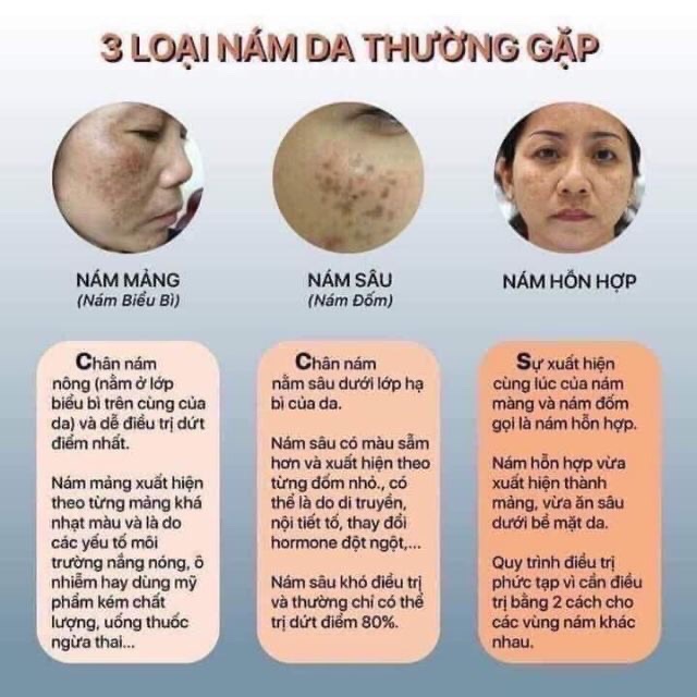 FACE NÁM TẢO HUYỀN CÒ - sp mới 2020