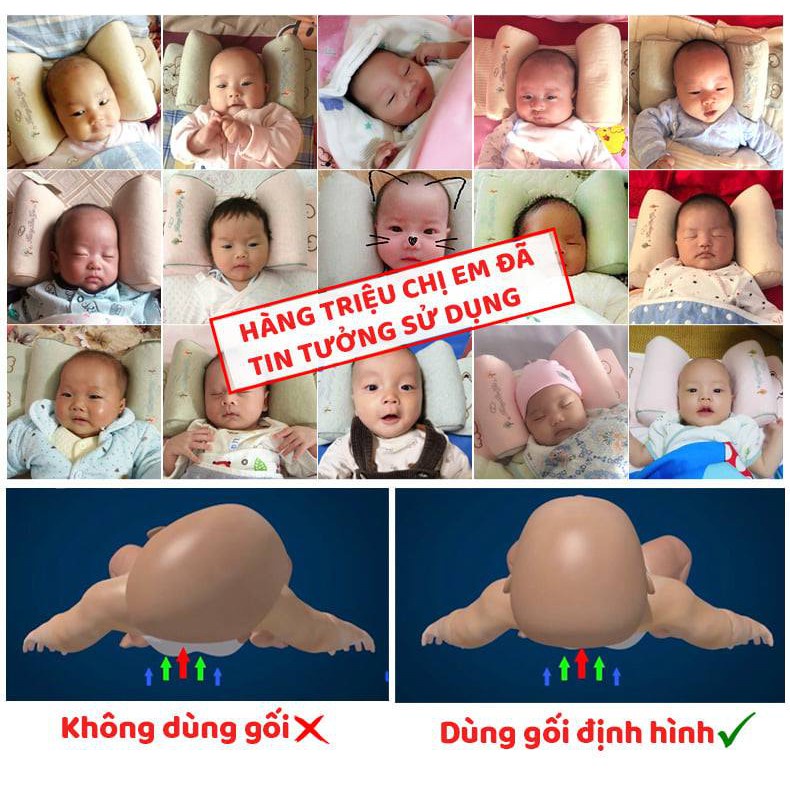 Gối Định Hình Đầu Thông Minh Chống Méo Đầu, Bẹp Đầu Cho BÉ