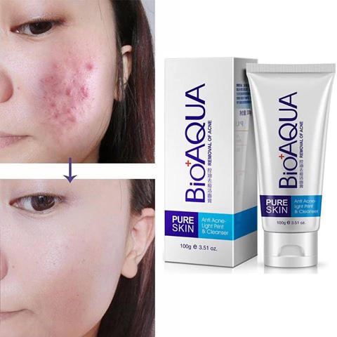 Sữa rửa mặt, gel rửa mặt giảm mụn Bioaqua nội địa dùng siêu tốt-SR26-B2T1 | BigBuy360 - bigbuy360.vn