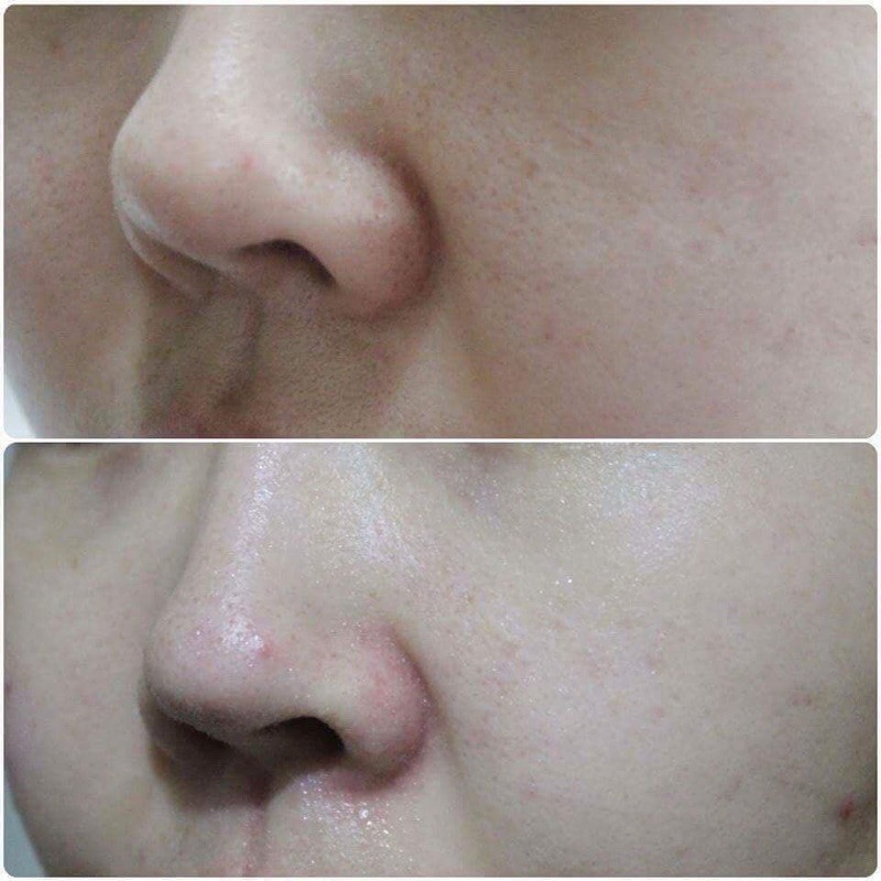 Sữa Rửa Mặt Ciracle Anti-Blemish Teatree Wash