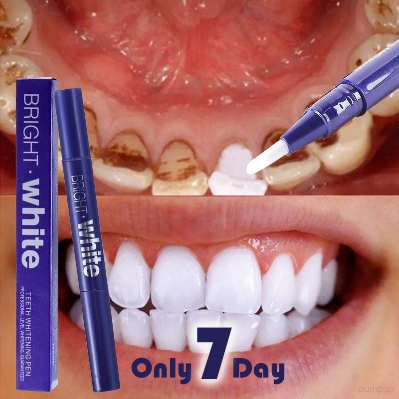 Bút Gel Làm Trắng Răng Loại Bỏ Vết Bẩn