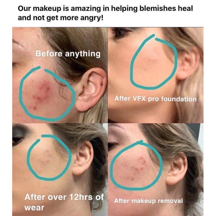 Serum Pro Heal IS CLINICAL