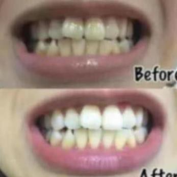 Combo 14 miếng (7 gói/7 ngày) dán trắng răng Crest 3D White Whitestrips loại Professional Effects - Mỹ