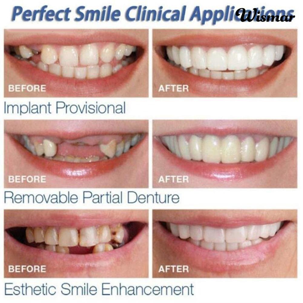 Set 2 Hàm Răng Giả Bằng Silicon Tính Thẩm Mỹ Cao