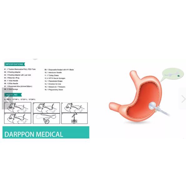 Dây ăn thành bụng, mở thông dạ dày, silicone, đặt lâu, có bóng cố định
