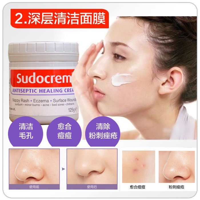 Britain SUDOCREM PPLê Tã Kem Trị Mụn Mụn Để Mụn Đầu Đen Mụn Chuyên Sâu Làm Sạch Mặt Nạ