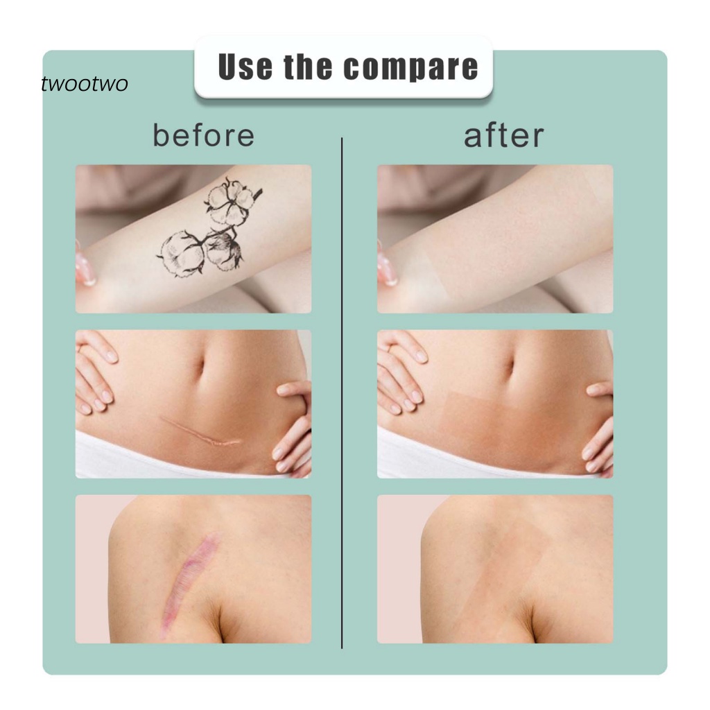 Miếng Dán Che Sẹo Hình Xăm Tiện Dụng Cho Nữ