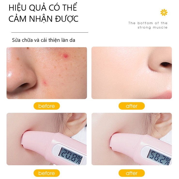 Set dưỡng da hoa cúc MAIGOOLE Repair And Moisturizing (MG33)