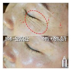 Tinh Chất Căng Bóng Làm Sáng Trẻ Hóa Medipeel Medi peel Peptide 9 Volume Bio Tox Biotox 100ml