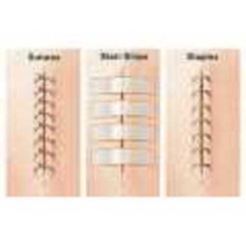 Băng dính thay chỉ khâu da 3M Nexcare H1546