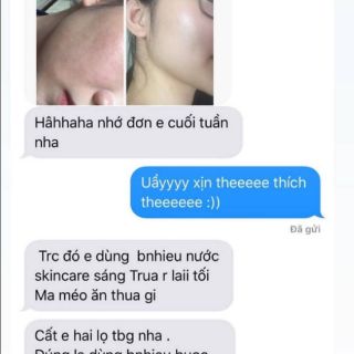 Tế bào gốc Thuringen Placenta 8ml