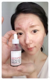 Serum Red Peel Tingle 25ml
