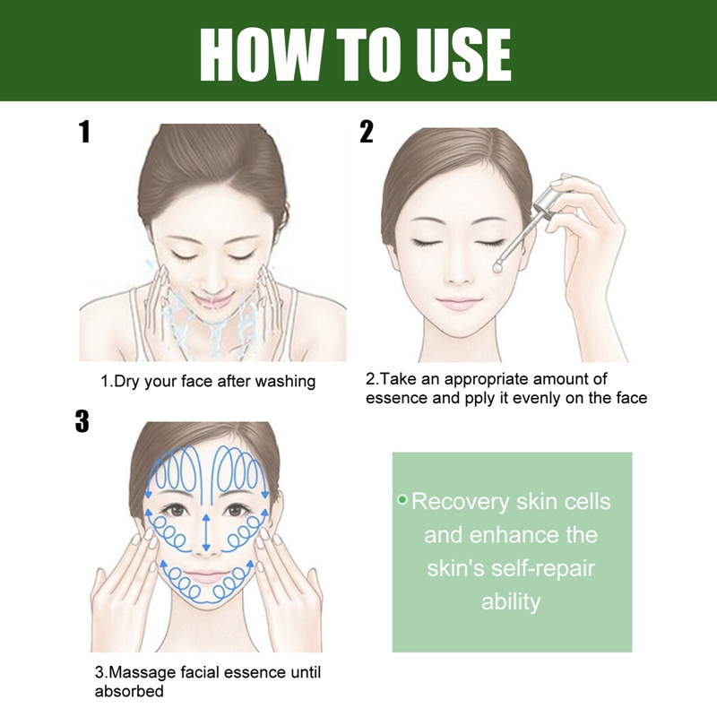 Serum Trà Xanh Kiểm Soát Dầu Thu Nhỏ Lỗ Chân Lông Làm Trắng Da Loại Bỏ Đốm Đen Cải Thiện