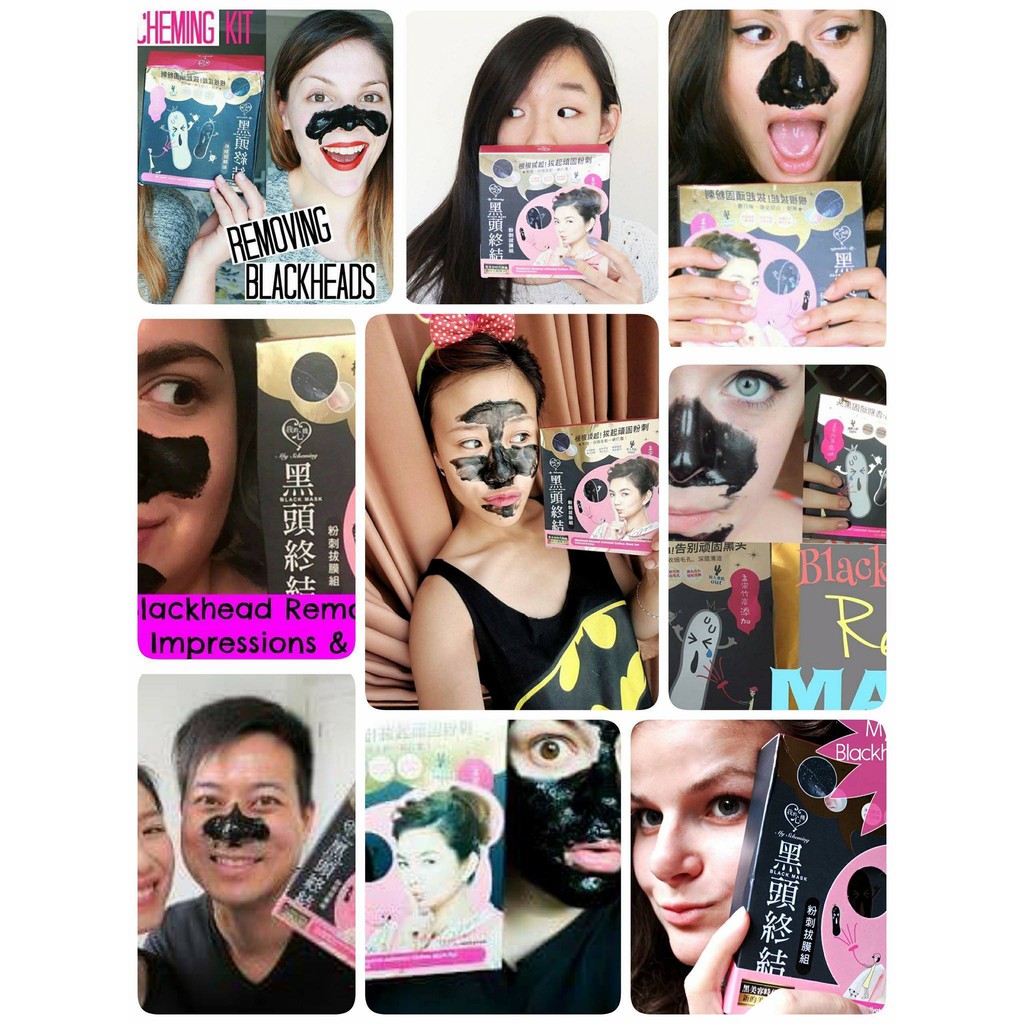 Bộ lột mụn My Scheming