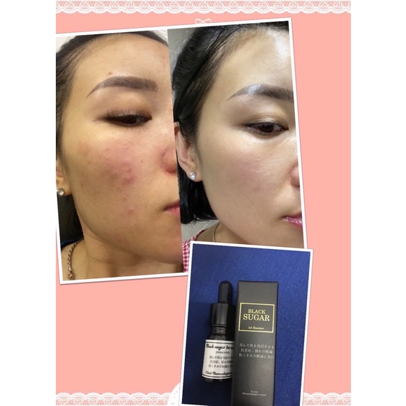 Serum đường đen BLACK SUGAR