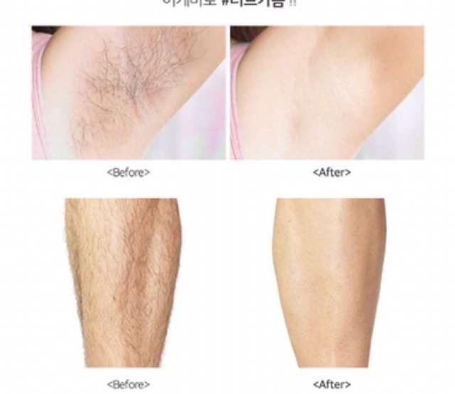 Kem Wax Lông Dịu Nhẹ Với Da, Không Gây Kích Ứng G9SKIN Shining Waxing Cream 100g | BigBuy360 - bigbuy360.vn