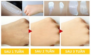 SET MINI DƯỠNG DA CAO CẤP LALAYA