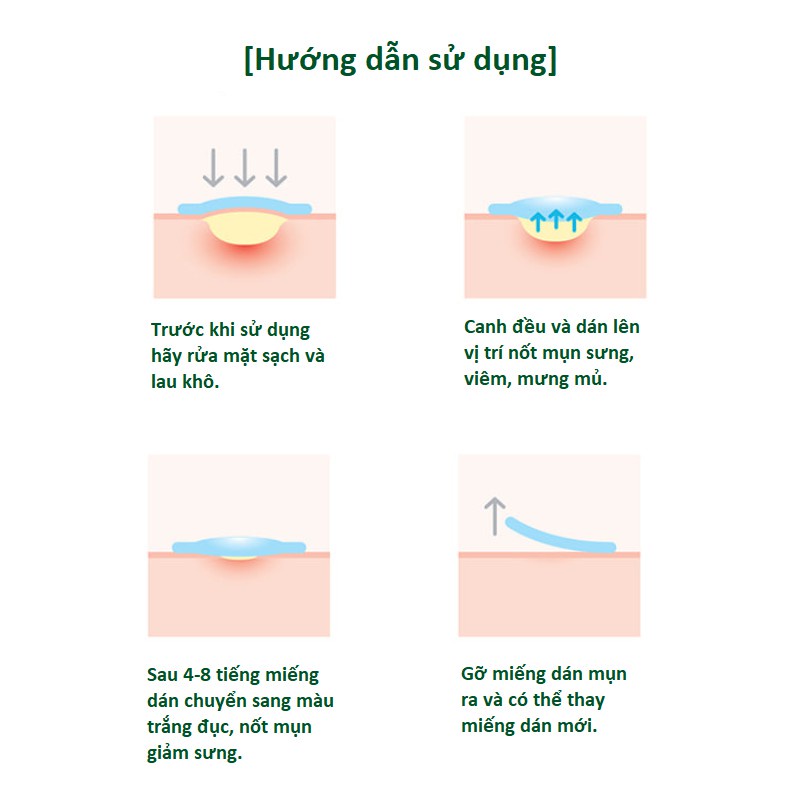 Miếng Dán Mụn Some By Mi Clear Spot Patch