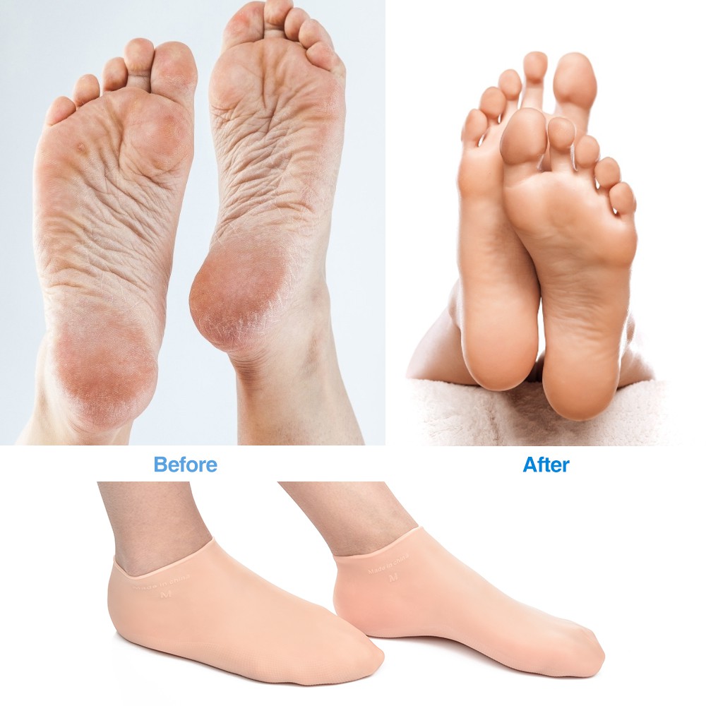 1 Cặp Găng Tay / Chân Bằng silicone gelx Giữ Ẩm Chống Nứt Nẻ