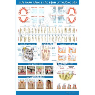 Tranh nha khoa "Giải phẫu và các bệnh lý thường gặp"