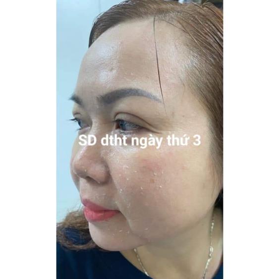 HOT! Sale GIỜ VÀNG, Kem peel da trẻ hóa PRP1 ĐÔNG TRÙNG HẠ THẢO