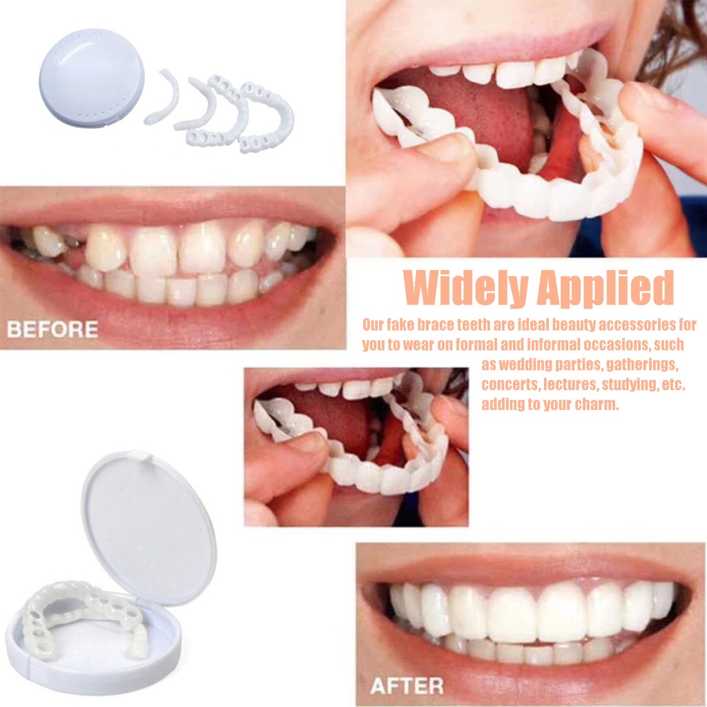 FUN~Fake Brace Smiling Veneers Teeth Braces Durable White Tools Healthy Creative Tooth Cover And Lower False Dentures Cosmetic Upper