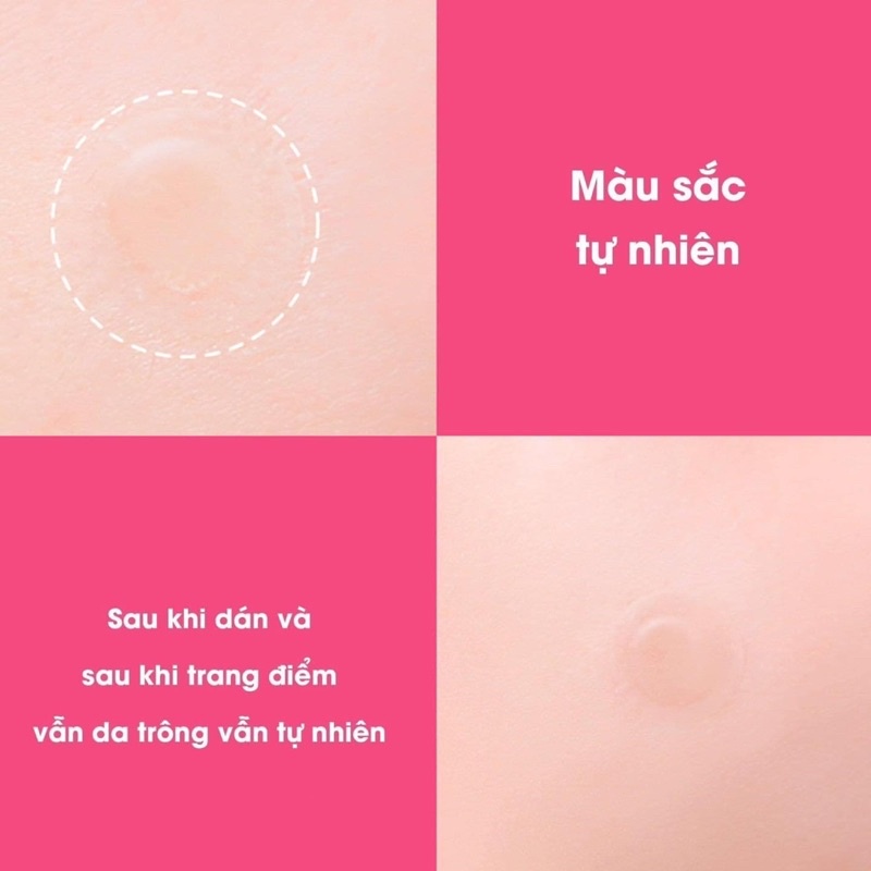Miếng Dán Mụn Neogen A-Clear Soothing Clear Spot Patch