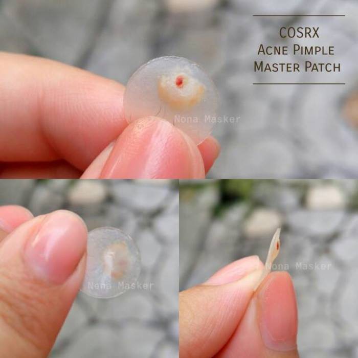 Miếng Dán Mụn Cosrx Acne Pimper Master Patch