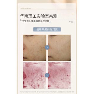 [SẴN] Serum B56 phục hồi da Lucenbase P50