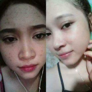 Kem face n collagen